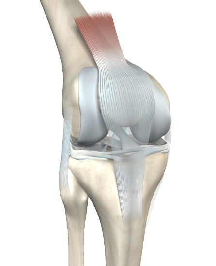 Ruptură de ligament a genunchiului – tipuri de tratament